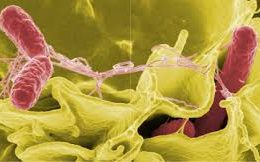 Trực khuẩn Salmonella gây bệnh thương hàn.