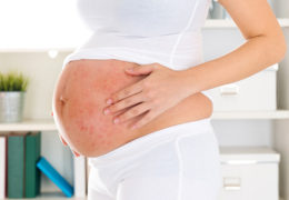 Những điều cần biết về bệnh chàm ở phụ nữ mang thai