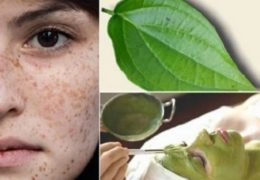 4 cách trị nám da với lá trầu không siêu hiệu quả