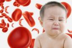 Thiếu máu do thiếu sắc ở trẻ em, vấn đề phụ huynh cần quan tâm hiện nay