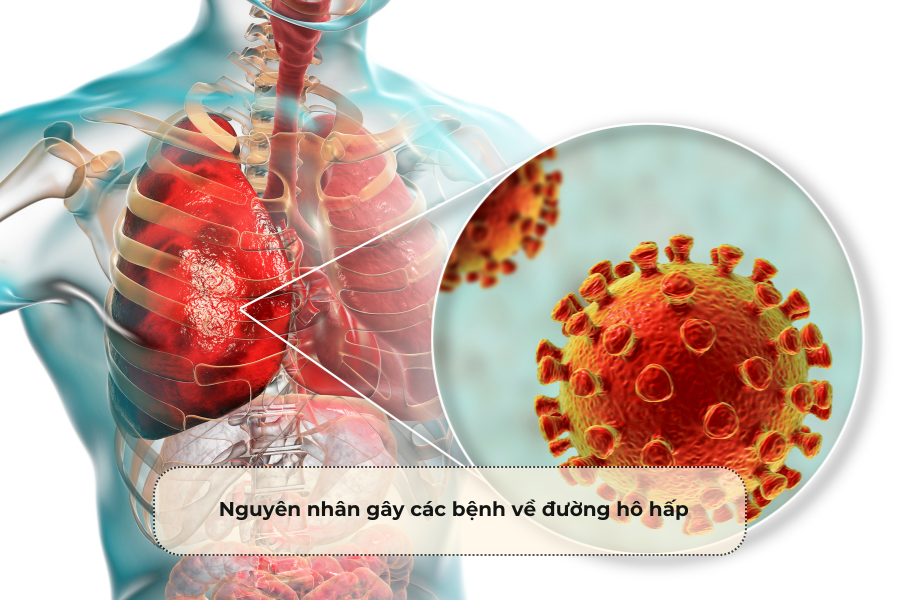 Nguyên nhân gây các bệnh về đường hô hấp
