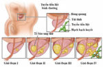 Cao Vị Nhân Có Tốt Không? Tổng Hợp Thông Tin Cần Biết Trước Khi Sử Dụng Cao Vị Nhân Có Tốt Không? Tổng Hợp Thông Tin Cần Biết Trước Khi Sử Dụng