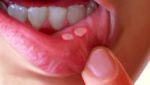 7 sai lầm khi chăm sóc tóc khiến tóc gãy rụng nhiều hơn và biện pháp khắc phục 7 sai lầm khi chăm sóc tóc khiến tóc gãy rụng nhiều hơn và biện pháp khắc phục