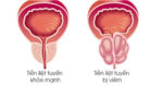 Cao Vị Nhân Có Tốt Không? Tổng Hợp Thông Tin Cần Biết Trước Khi Sử Dụng