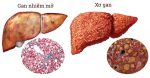 Bao Cao Su Có Gai – Tìm Hiểu Từ A Đến Z Về Đặc Điểm, Tác Dụng Và Lưu Ý Khi Sử Dụng