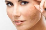 Bình Vị Nam Bivina Là Thuốc Gì? Công Dụng, Cách Dùng Và Những Điều Cần Biết