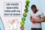 Cây thuốc nam chữa viêm loét dạ dày tá tràng: Giải pháp tự nhiên hỗ trợ điều rị