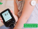 Máy Đo Đường Huyết Không Cần Lấy Máu: Có Nên Tin Vào Công Nghệ Này Không?