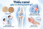 Thiếu canxi gây ra những bệnh gì? Dấu hiệu và cách phòng ngừa Thiếu canxi gây ra những bệnh gì? Dấu hiệu và cách phòng ngừa