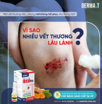 Vết thương hở lâu lành: nguyên nhân và hướng chăm sóc đúng cách